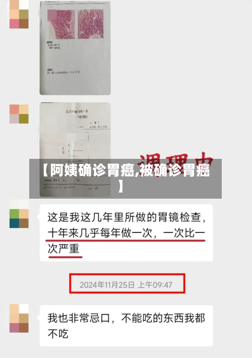 【阿姨确诊胃癌,被确诊胃癌】-第3张图片