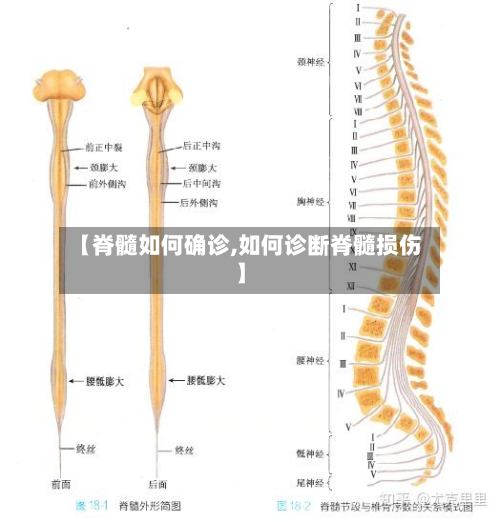 【脊髓如何确诊,如何诊断脊髓损伤】-第3张图片