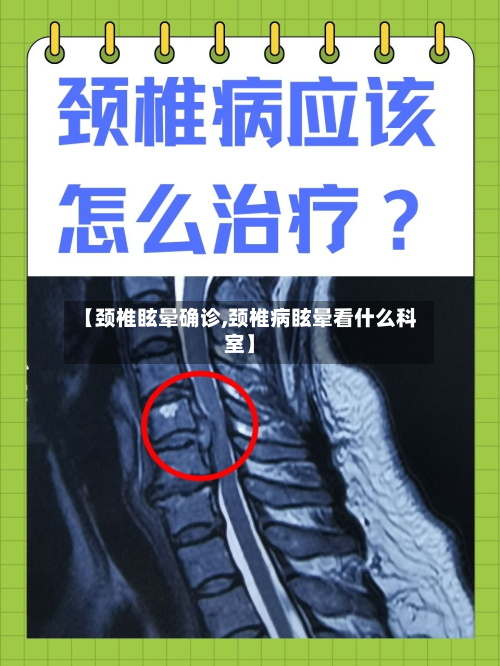 【颈椎眩晕确诊,颈椎病眩晕看什么科室】-第2张图片
