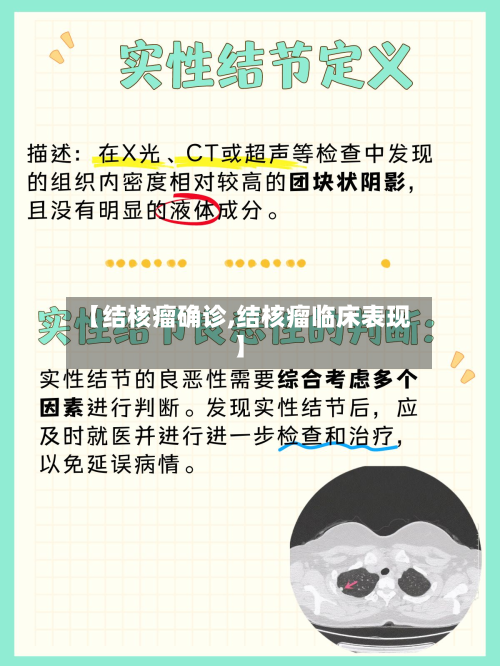 【结核瘤确诊,结核瘤临床表现】