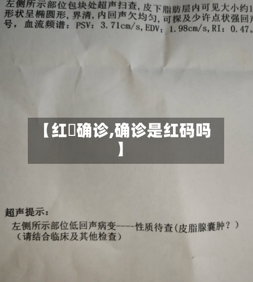 【红磡确诊,确诊是红码吗】