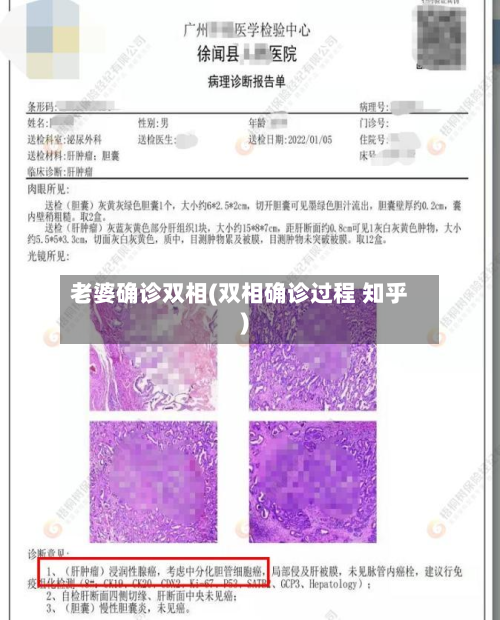 老婆确诊双相(双相确诊过程 知乎)-第2张图片