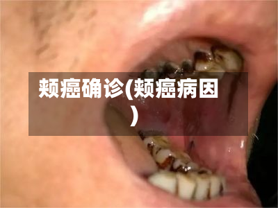 颊癌确诊(颊癌病因)