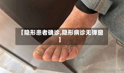 【隐形患者确诊,隐形病诊无弹窗】-第2张图片