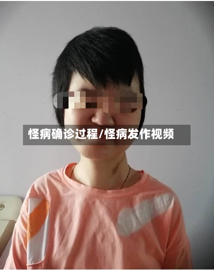 怪病确诊过程/怪病发作视频-第2张图片