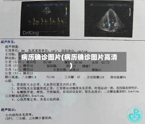 病历确诊图片(病历确诊图片高清)-第2张图片