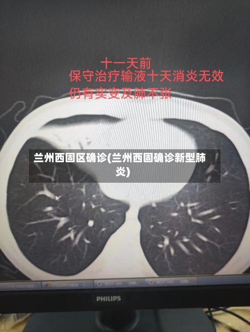兰州西固区确诊(兰州西固确诊新型肺炎)