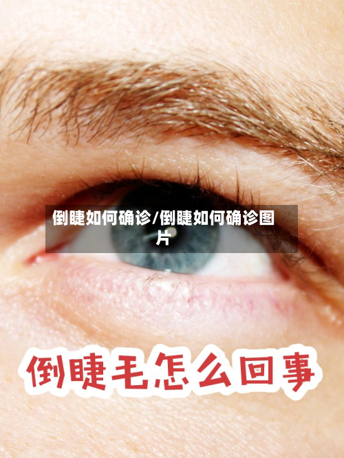 倒睫如何确诊/倒睫如何确诊图片-第2张图片